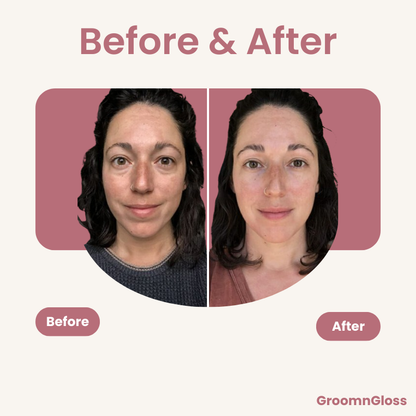 Thermalift™ – The 7-in-1 LED Facial Sculptor